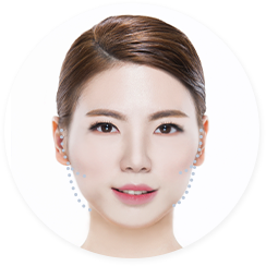 Fat Dissolving Injections in Korea - Fat Dissolving Injections in Korea