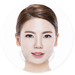 Fat Dissolving Injections in Korea - Fat Dissolving Injections in Korea